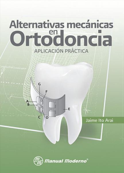 Alternativas mecánicas en ortodoncia. Aplicación práctica. 