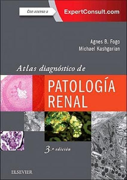 Atlas diagnóstico de patología renal + ExpertConsult