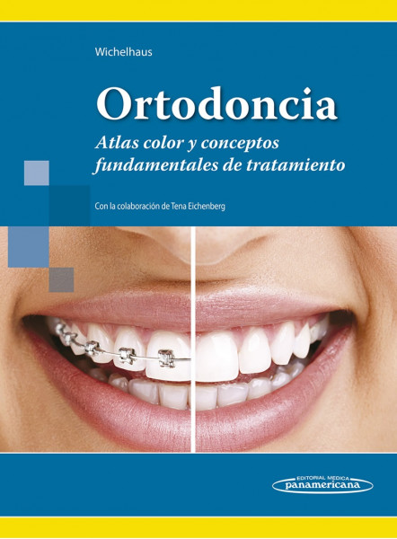 Ortodoncia (Atlas color y conceptos fundamentales de tratamiento)