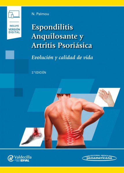 Espondilitis Anquilosante y Artritis Psoriásica (incluye versión digital)