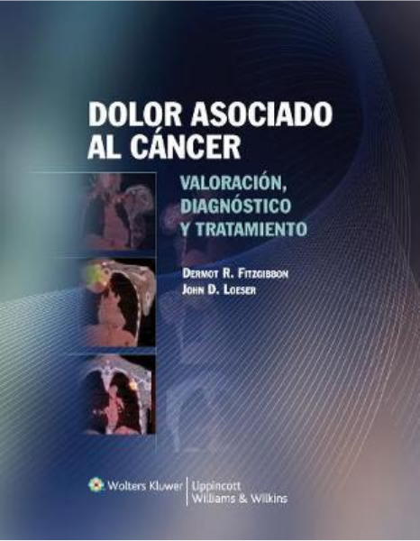 Dolor asociado al cáncer: evaluación, diagnóstico y tratamiento