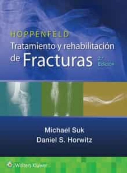Hoppenfeld Tratamiento y Rehabilitacion de Fracturas 
